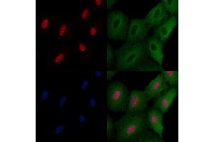 ABIN6258629 and ABIN6275742 staining  cells by IF/ICC.