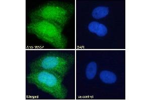Immunofluorescence (IF) image for anti-Wiskott-Aldrich Syndrome (Eczema-thrombocytopenia) (WAS) (Internal Region) antibody (ABIN185368)