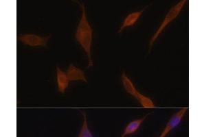 Immunofluorescence analysis of NIH-3T3 cells using MLPH Polyclonal Antibody at dilution of 1:100. (Melanophilin 抗体)