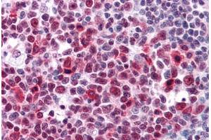 Immunohistochemistry (Formalin-fixed Paraffin-embedded Sections) (IHC (fp)) image for anti-High Mobility Group Box 2 (HMGB2) (AA 1-196) antibody (ABIN574280)