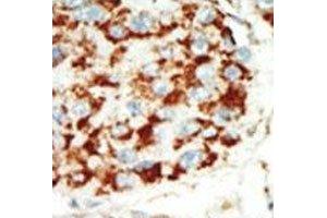 Immunohistochemistry (IHC) image for anti-Protein Kinase, AMP-Activated, beta 1 Non-Catalytic Subunit (PRKAB1) (AA 4-34) antibody (ABIN3032386)
