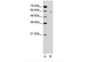 Image no. 1 for anti-Cell Division Cycle 23 (CDC23) (C-Term) antibody (ABIN6736648) (CDC23 抗体  (C-Term))