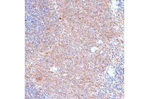Immunohistochemistry of paraffin-embedded rat spleen using G3BP1 antibody (ABIN7267528) at dilution of 1:100 (40x lens). (G3BP1 抗体  (AA 131-330))
