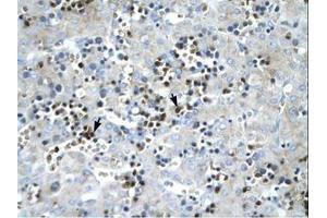 Image no. 1 for anti-Stearoyl-CoA Desaturase (Delta-9-Desaturase) (SCD) (AA 190-239) antibody (ABIN202340) (SCD 抗体  (AA 190-239))