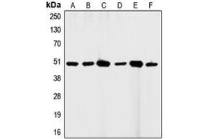 Western blot analysis of CD95 expression in HeLa (A), A431 (B), K562 (C), HL60 (D), mouse brain (E), H9C2 (F) whole cell lysates. (FAS 抗体  (C-Term))