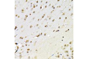 Immunohistochemistry of paraffin-embedded mouse brain using RUNX1 Antibody (ABIN3022803, ABIN3022804, ABIN3022805 and ABIN6219236) at dilution of 1:100 (40x lens). (RUNX1 抗体  (AA 150-250))