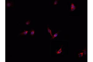 Immunofluorescence (fixed cells) (IF/ICC) image for anti-Complement Factor B (CFB) (Internal Region) antibody (ABIN6260775)