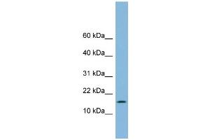 WB Suggested Anti-UBE2L6 Antibody Titration: 0. (UBE2L6 抗体  (Middle Region))