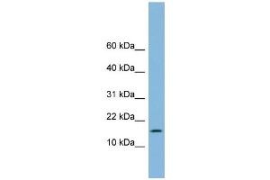 WB Suggested Anti-UBE2L6 Antibody Titration: 0. (UBE2L6 抗体  (Middle Region))