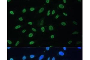 Immunofluorescence analysis of U-2 OS cells using HNRNPD Polyclonal Antibody at dilution of 1:100. (HNRNPD/AUF1 抗体)