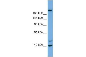 Western Blotting (WB) image for anti-Inositol Polyphosphate-5-Phosphatase F (INPP5F) (N-Term) antibody (ABIN2786063) (INPP5F 抗体  (N-Term))