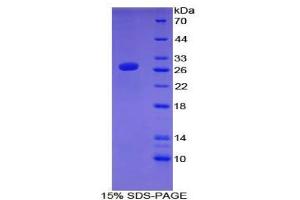 SDS-PAGE analysis of Mouse ATF7 Protein. (AFT7 蛋白)
