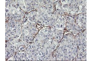 Immunohistochemistry (IHC) image for anti-Mesoderm Induction Early Response 1, Family Member 2 (MIER2) (AA 1-296) antibody (ABIN1490703) (MIER2 抗体  (AA 1-296))