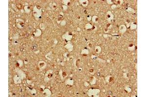 Immunohistochemistry of paraffin-embedded human brain tissue using ABIN7152131 at dilution of 1:100 (EIF2S1 抗体  (AA 276-315))