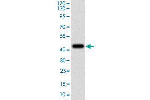 Western blot analysis of human FTL (AA: 1-157) recombinant protein (Expected MW is 45. (FTL 抗体)