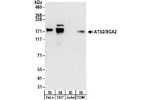 anti-Ataxin 2 (ATXN2) (AA 1262-1312) antibody