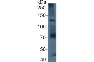 Detection of LAMb3 in Mouse Lung lysate using Polyclonal Antibody to Laminin Beta 3 (LAMb3) (Laminin beta 3 抗体  (AA 595-778))