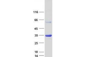 Validation with Western Blot
