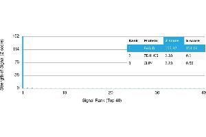 Protein Array (PAr) image for anti-Parvalbumin (PVALB) antibody (ABIN7455989) (PVALB 抗体)