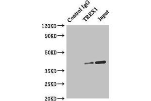 TREX1 抗体  (AA 1-270)