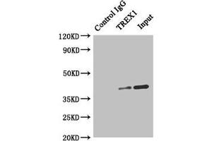 Immunoprecipitating TREX1 in Hela whole cell lysate Lane 1: Rabbit control IgG instead of (1 μg) instead of ABIN7172071 in Hela whole cell lysate. (TREX1 抗体  (AA 1-270))