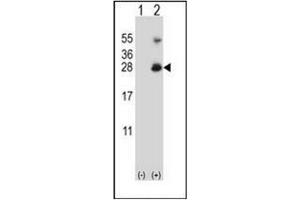 Western blot analysis of RNF11 (arrow) using RNF11 Antibody (Center) Cat. (RNF11 抗体  (Middle Region))