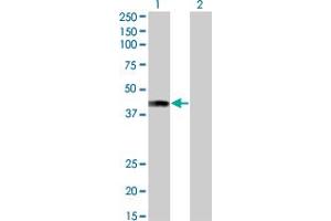 Western Blot analysis of AFF4 expression in transfected 293T cell line by AFF4 monoclonal antibody (M01), clone 2E12. (AFF4 抗体  (AA 1-108))