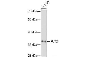 Western blot analysis of extracts of HT-29 cells using FUT2 Polyclonal Antibody at dilution of 1:1000. (FUT2 抗体)