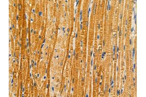 Phospho-ABCA1 (Ser2054) Antibody at 1/100 staining Rat heart tissue by IHC-P.
