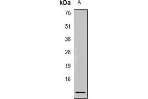 Western blot analysis of S100-A1 expression in Hela (A) whole cell lysates. (S100A1 抗体)