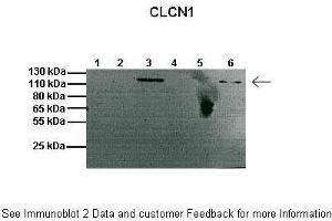 Lanes:   1: 20ug mouse muscle membrane fraction, 2: Empty, 3: 20ug mouse brain membrane fraction, 4: Empty, 5: 20ug mouse muscle cytosolic fraction, 6: 20ug mouse brain cytosolic fraction  Primary Antibody Dilution:   1:1000  Secondary Antibody:   Anti-rabbit HRP  Secondary Antibody Dilution:   1:2000  Gene Name:   Clcn1  Submitted by:   Anonymous (CLCN1 抗体  (C-Term))