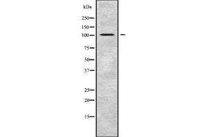 Western blot analysis of TUBGCP2 using HT29 whole cell lysates (TUBGCP2 抗体  (Internal Region))