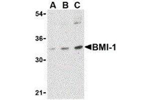 Western Blotting (WB) image for anti-BMI1 Polycomb Ring Finger Oncogene (BMI1) (Center) antibody (ABIN2477677) (BMI1 抗体  (Center))