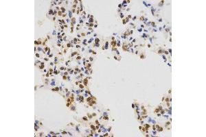 Immunohistochemistry (IHC) image for anti-Histone 3 (H3) (H3K36me3) antibody (ABIN3016039)