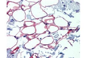 Immunohistochemistry (IHC) image for anti-Nuclear Factor I/C (CCAAT-Binding Transcription Factor) (NFIC) (Middle Region) antibody (ABIN2792686)