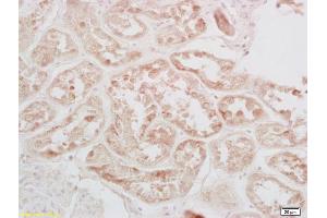 Formalin-fixed and paraffin embedded human kidney labeled with Rabbit Anti-phospho-CREB-1(Ser133) Polyclonal Antibody (ABIN723980) at 1:200 followed by conjugation to the secondary antibody and DAB staining. (CREB1 抗体  (pSer133))