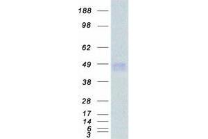 Validation with Western Blot