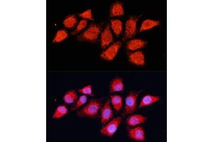 Immunofluorescence analysis of HeLa cells using PDH Polyclonal Antibody (ABIN6132882, ABIN6145379, ABIN6145381 and ABIN6225274) at dilution of 1:100 (40x lens).