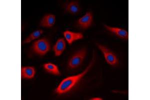 Immunofluorescent analysis of Calmodulin (pT80/S82) staining in A549 cells. (Calmodulin 1 抗体  (pSer80, pSer82))