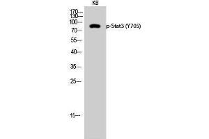 Western Blotting (WB) image for anti-Signal Transducer and Activator of Transcription 3 (Acute-Phase Response Factor) (STAT3) (pTyr705) antibody (ABIN3179505) (STAT3 抗体  (pTyr705))