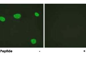 Immunofluorescence analysis of HeLa cells, using VDR polyclonal antibody . (Vitamin D Receptor 抗体  (Ser208))