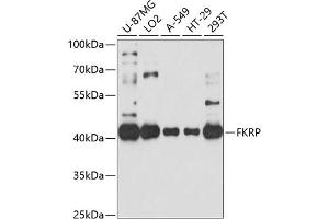 Western blot analysis of extracts of various cell lines, using FKRP antibody (ABIN6132005, ABIN6140666, ABIN6140667 and ABIN6214350) at 1:1000 dilution. (FKRP 抗体  (AA 30-220))
