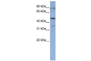 WB Suggested Anti-DAZAP1  Antibody Titration: 0. (DAZAP1 抗体  (Middle Region))