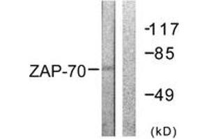 Western blot analysis of extracts from 293 cells, treated with PMA 125ng/ml 30', using ZAP-70 (Ab-292) Antibody. (ZAP70 抗体  (AA 258-307))