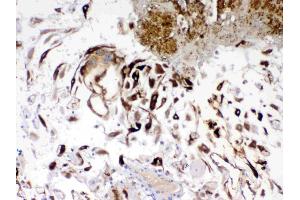 IHC analysis of IGFBP1 using anti- IGFBP1 antibody . (IGFBPI 抗体  (AA 69-259))