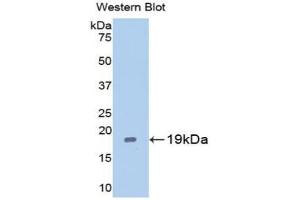 Western blot analysis of the recombinant protein. (Caspase 2 抗体  (AA 170-333))