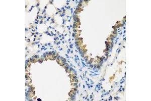 Immunohistochemistry of paraffin-embedded mouse lung using CYP2F1 antibody. (CYP2F1 抗体  (AA 100-290))