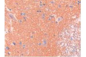 IHC-P analysis of Rat Spinal Cord Tissue, with DAB staining. (SPTAN1 抗体  (AA 2071-2269))