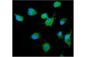 IF analysis of GRB14 using anti-GRB14 antibody (ABIN7599149). (GRB14 抗体  (AA 1-246))
