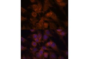 Immunofluorescence analysis of C6 cells using SEC23IP antibody (ABIN7270170) at dilution of 1:100. (SEC23IP 抗体  (AA 600-940))